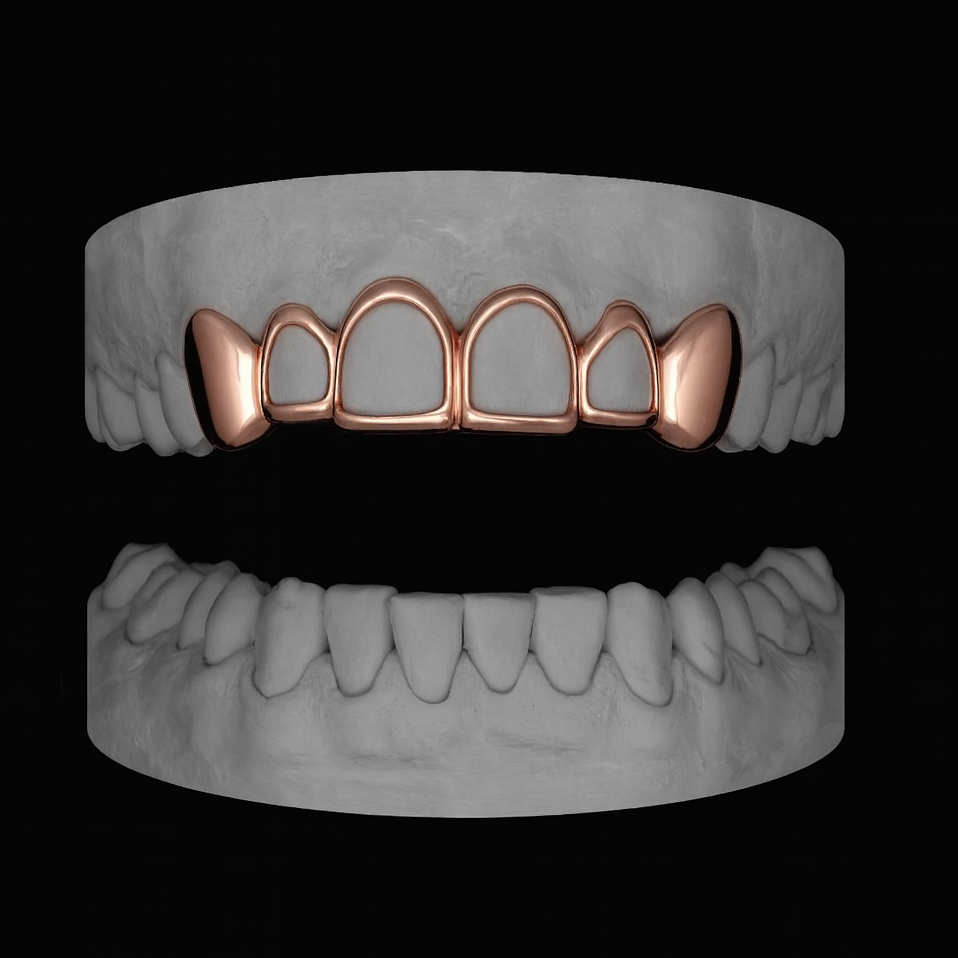 4 Window and 2 Caps Set