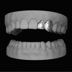 Winow Grillz Set on Canine and Incisor