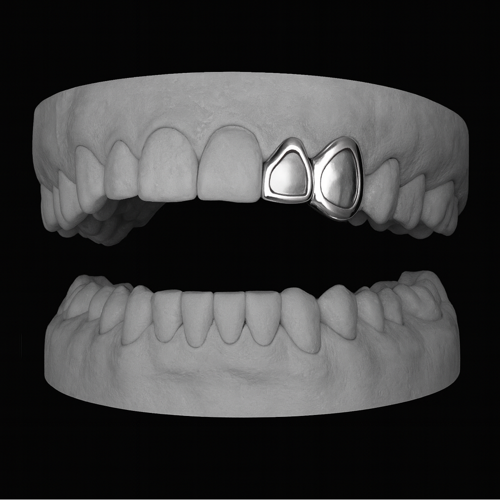 Winow Grillz Set on Canine and Incisor