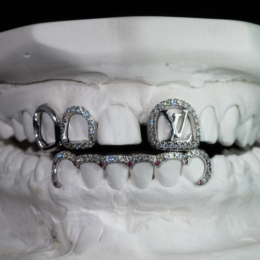 Special Ruby LV Window Design