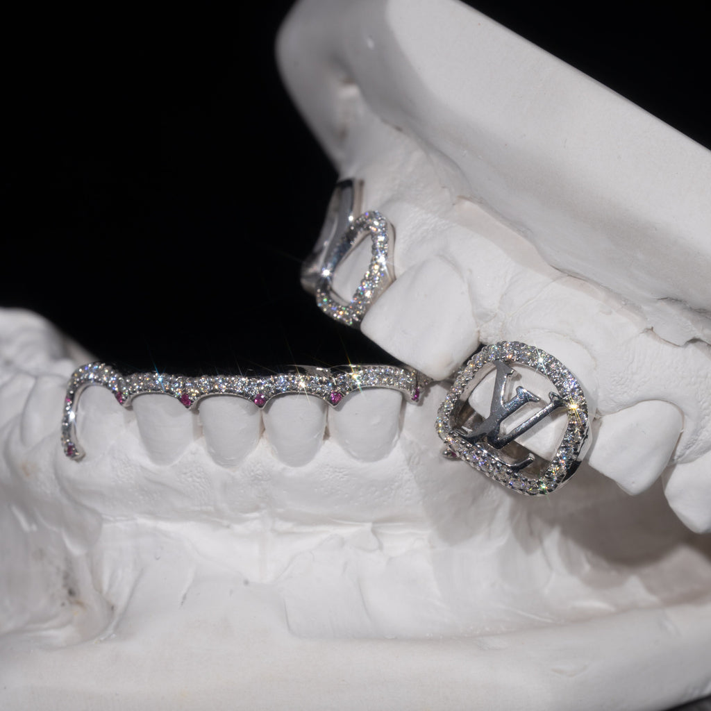 Special Ruby LV Window Design