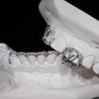 Special Ruby LV Window Design