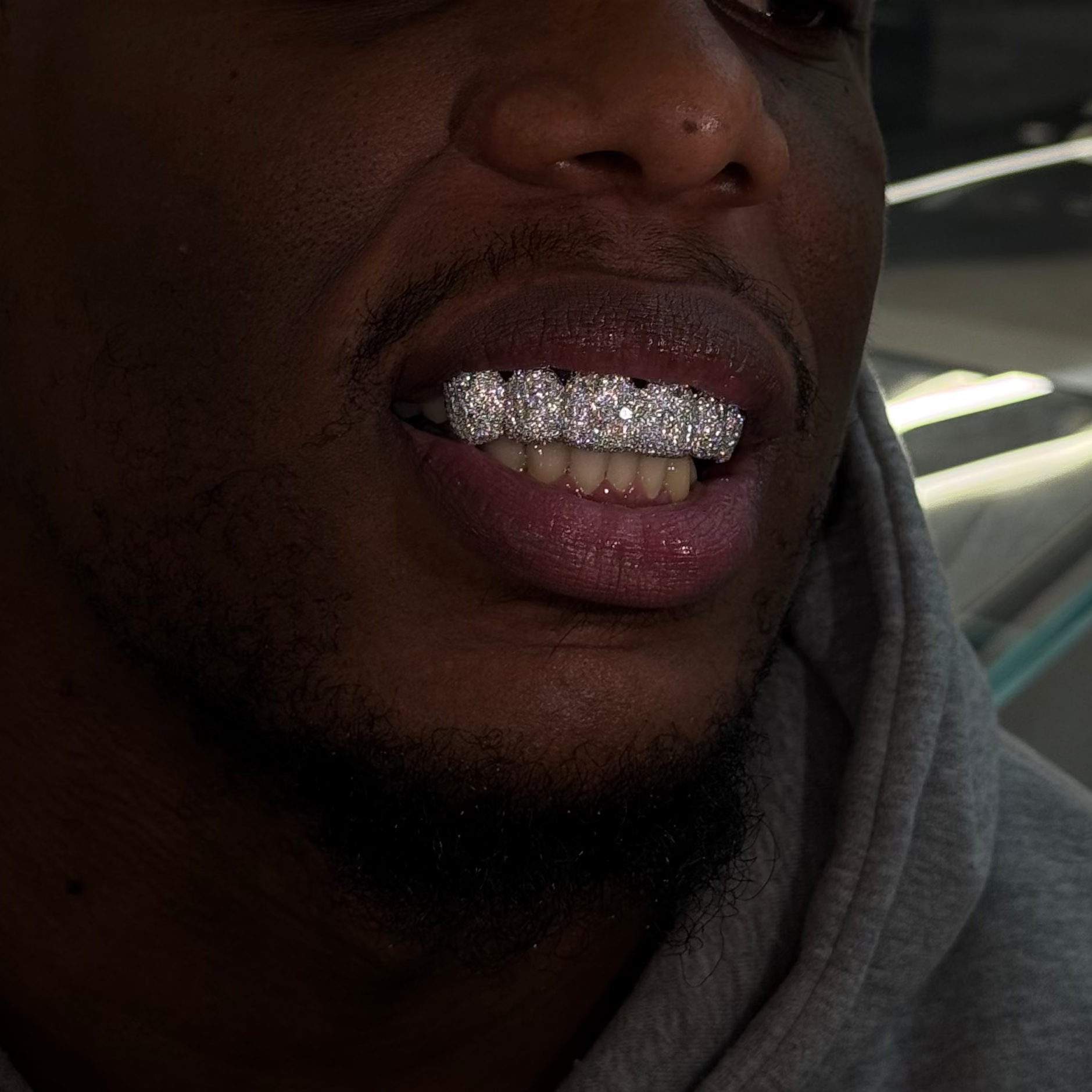 Mosaic Setting 6 Set