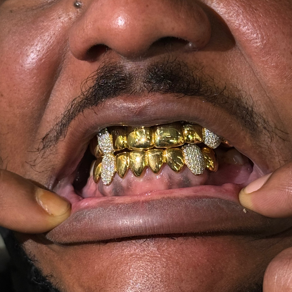 16 Plain Set | 4 Canines Iced Out