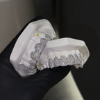 Mosaic Setting 6 Set