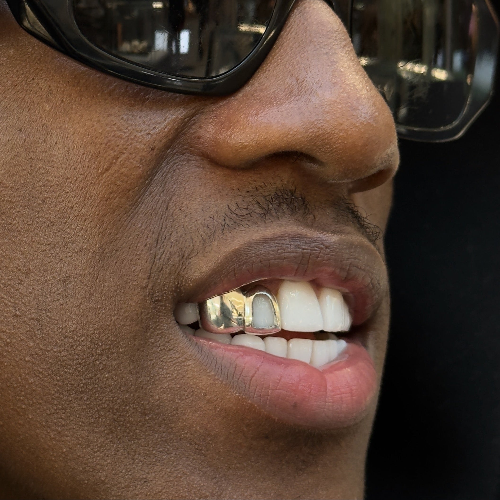 Full Cap and Window Set