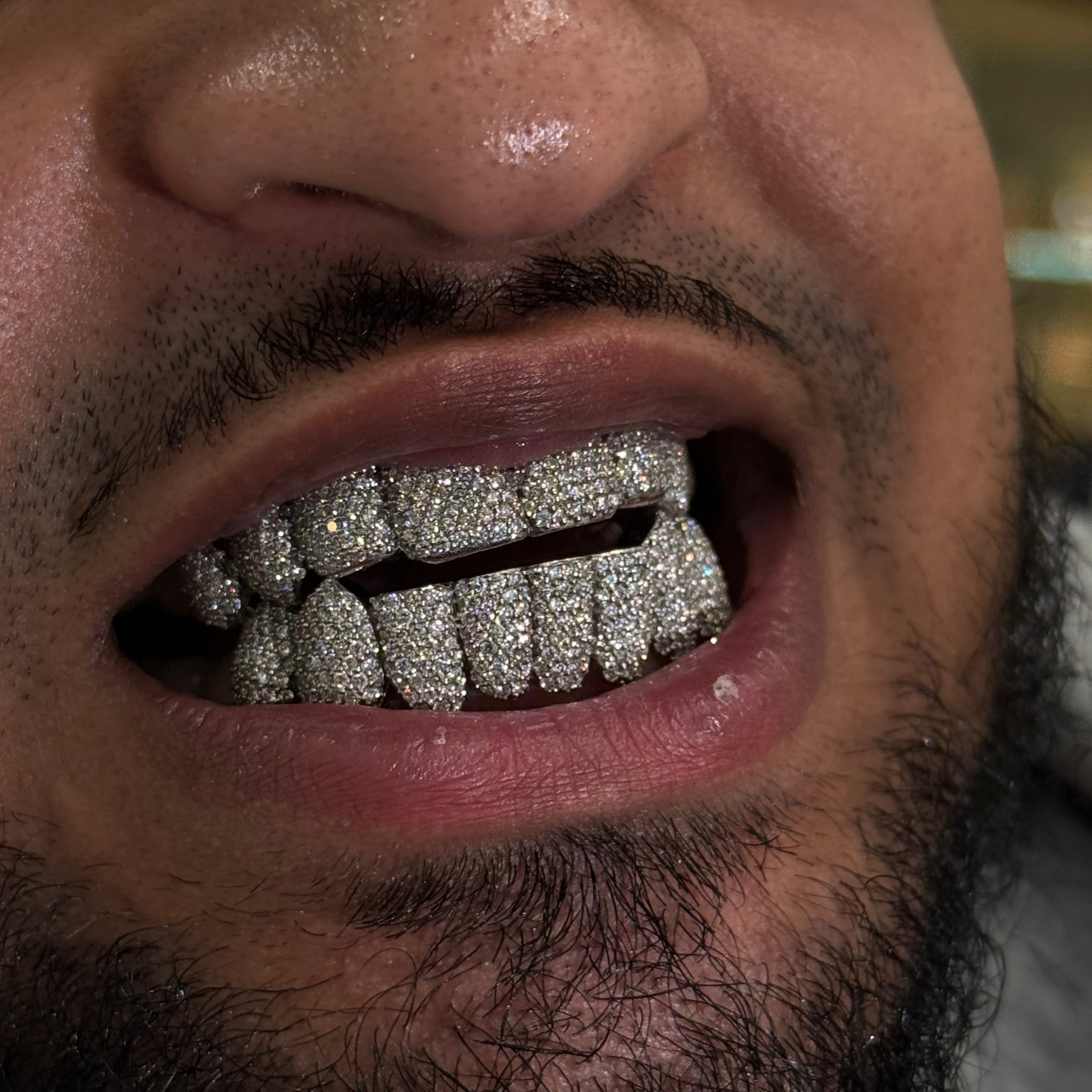 Iced Out Honeycomb Set Grillz