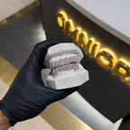 Baby Pink ICED out Mosaic Grillz