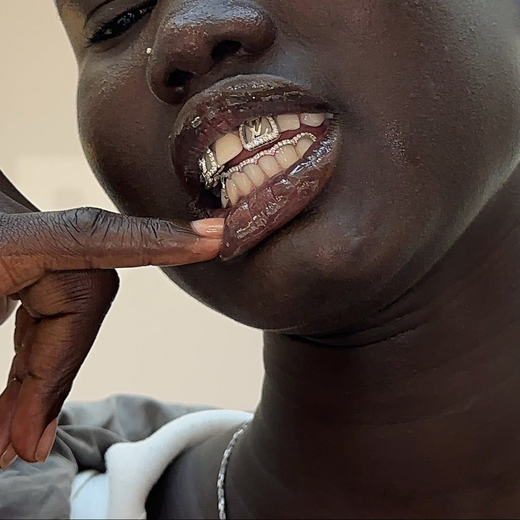 Special Ruby LV Window Design