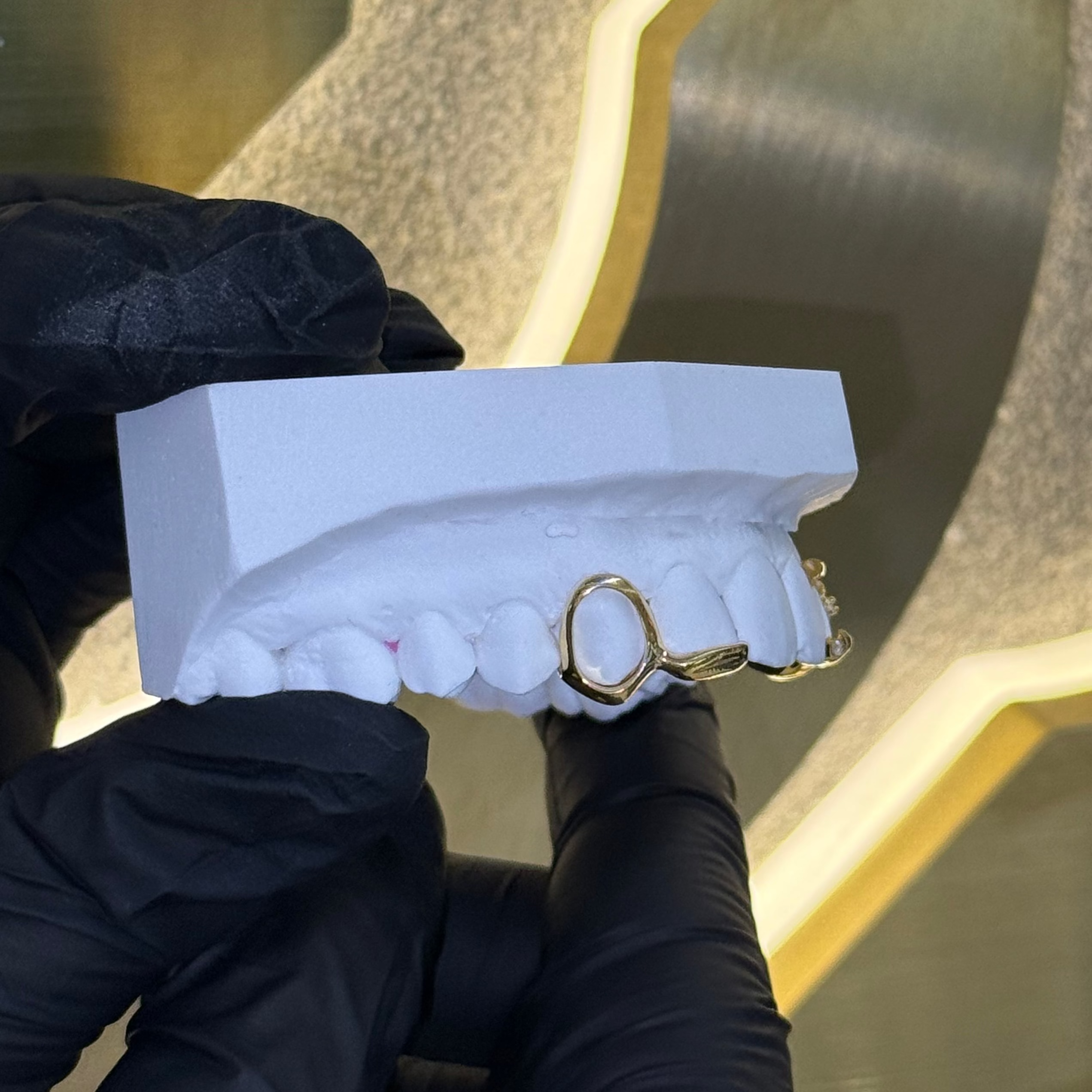 Single Window Inlay Bar