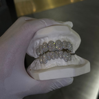 Iced Mosaic Setting Grillz