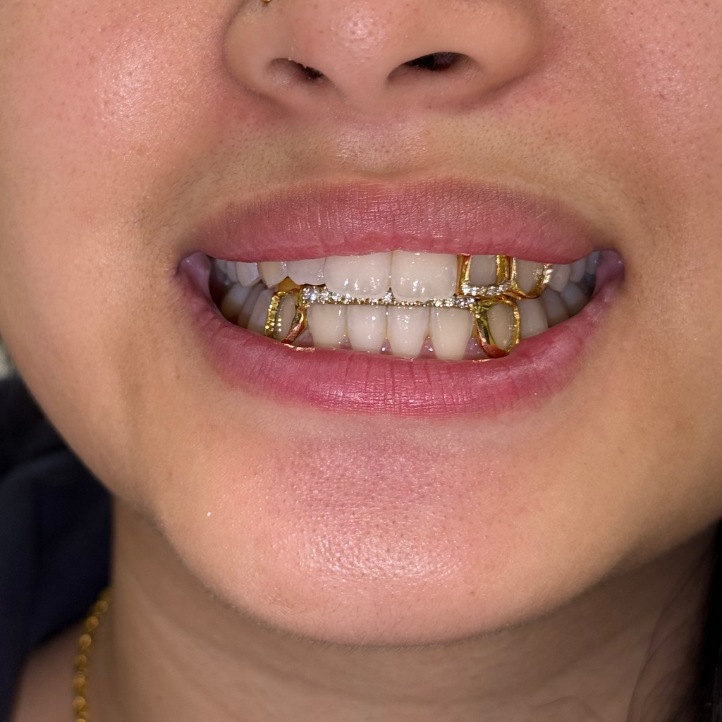Bottom K9 - K9 Bar Iced Grillz
